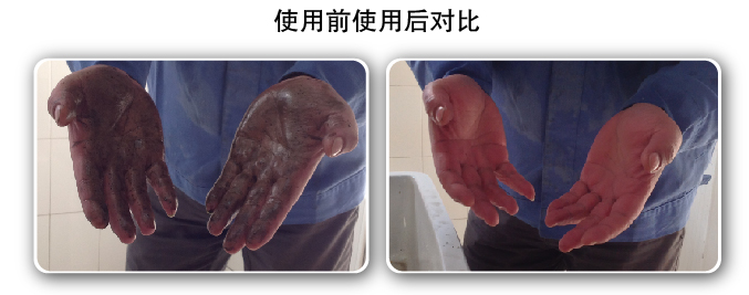使用磨砂洗手膏效果前后对比